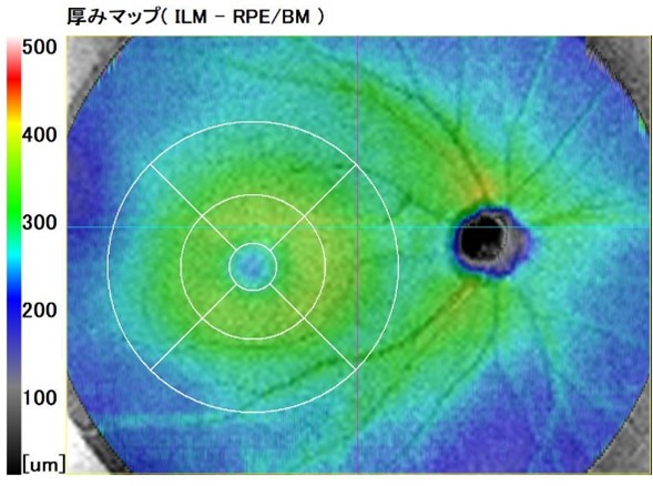 病気が見える！1.2.3.4.7.8 病気が見える！1.2.3.4.7.8 視力検査、1.0の次はどうして1.1ではなく