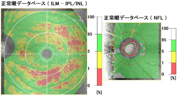 病気が見える！1.2.3.4.7.8 視力検査、1.0の次はどうして1.1ではなく1.2なの？ - 日本経済新聞